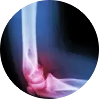 image of pain