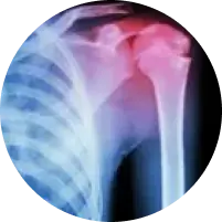 image of pain