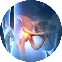 image of pain